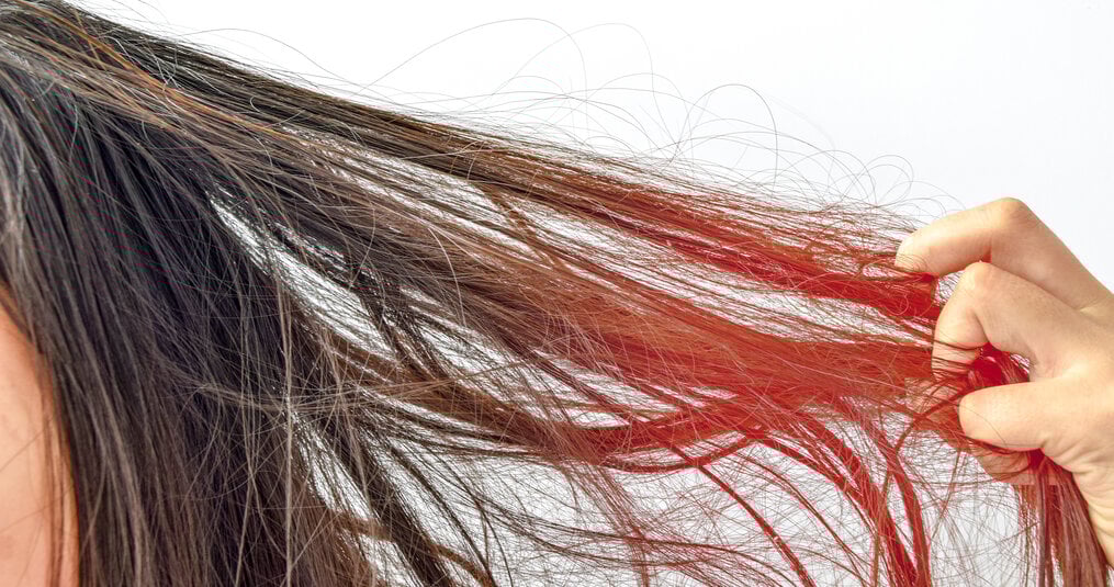 haar weer gezond krijgen